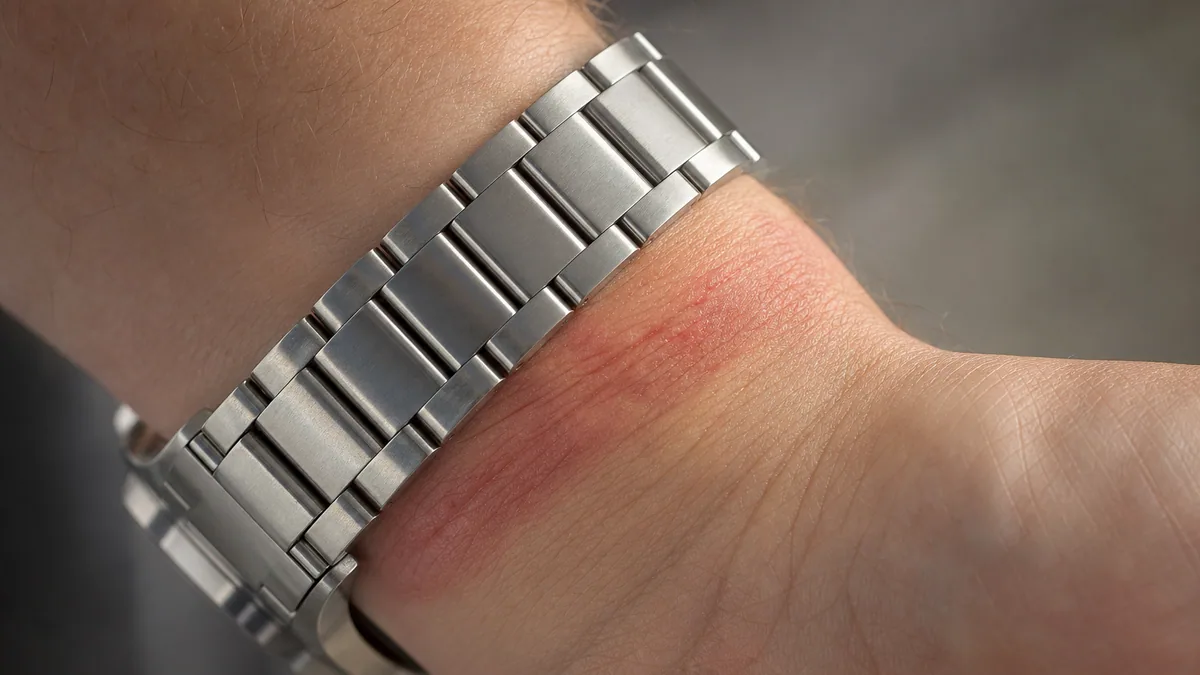 Bracelet de montre en métal porté au poignet avec une légère rougeur visible sur la peau