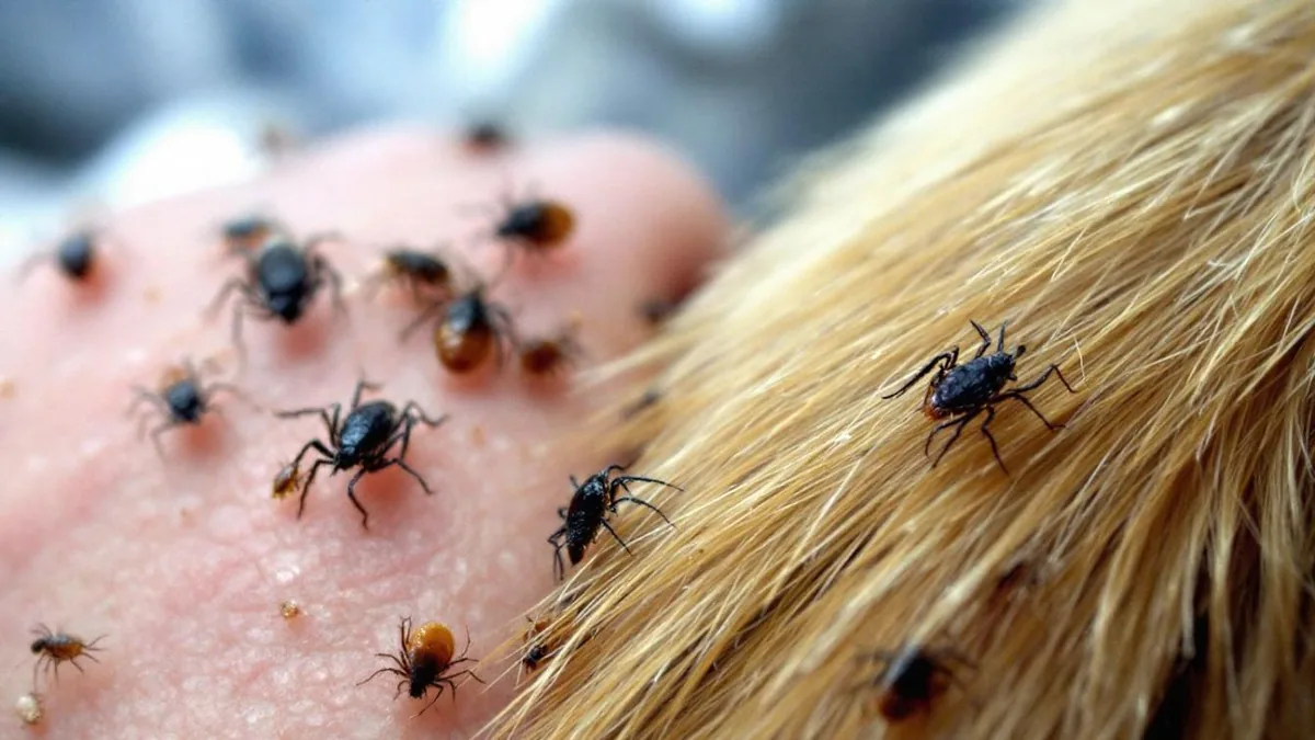 Gros plan comparatif d’un pou dans des cheveux et d’une tique fixée sur la peau